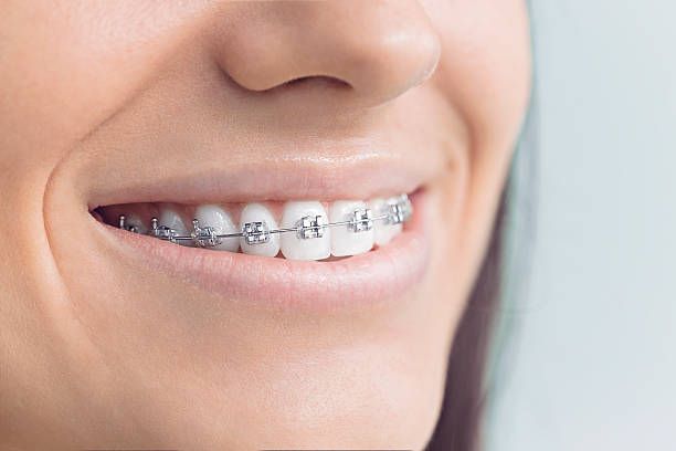 Dental Bonding in Pikeville, TN